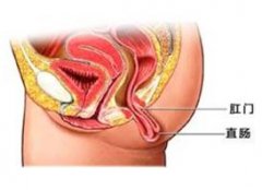 福州直肠脱垂去哪个医院治？