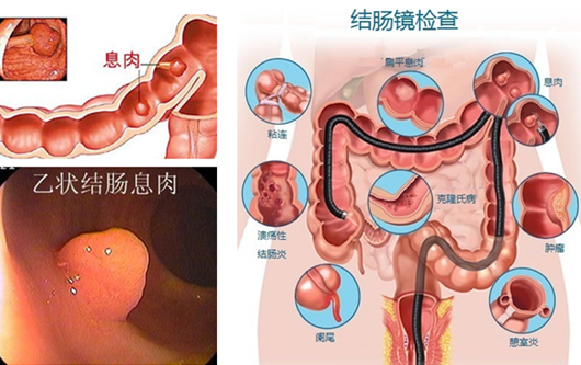 医博肛肠在哪呢靠不靠谱